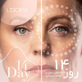 کرم لیفتینگ صورت و گردن ماساژور دار جوان ساز لدورا کر 100 میلی لیتر