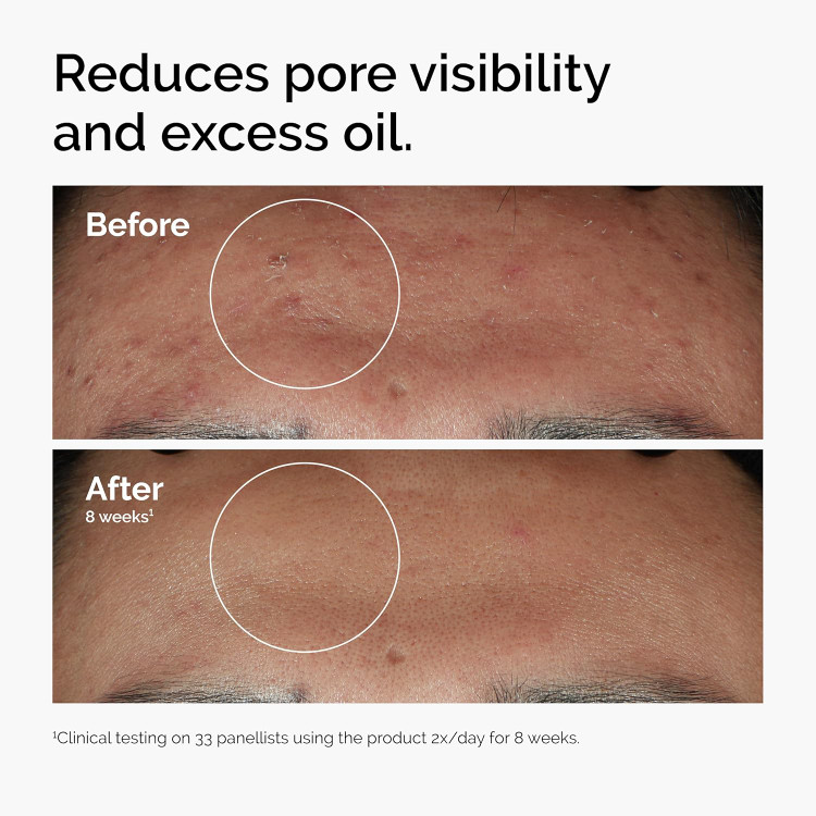 سرم نیاسینامید اردینری اصل