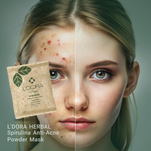 ماسک پودری اسپیرولینا ضدجوش لدورا هربال 10عددی